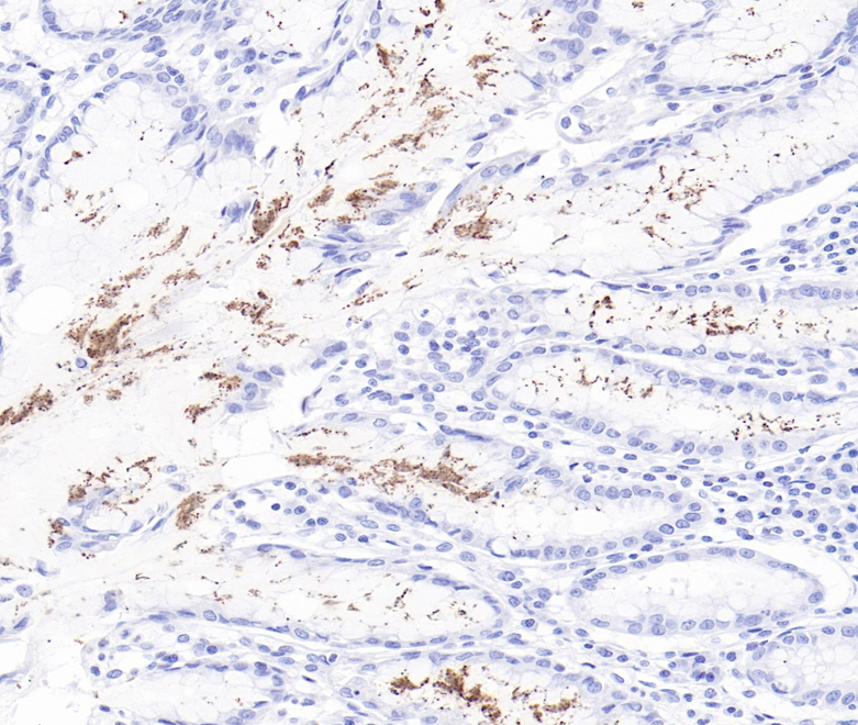 Helicobactor pylori Rabbit Monoclonal Antibody(ARB587)