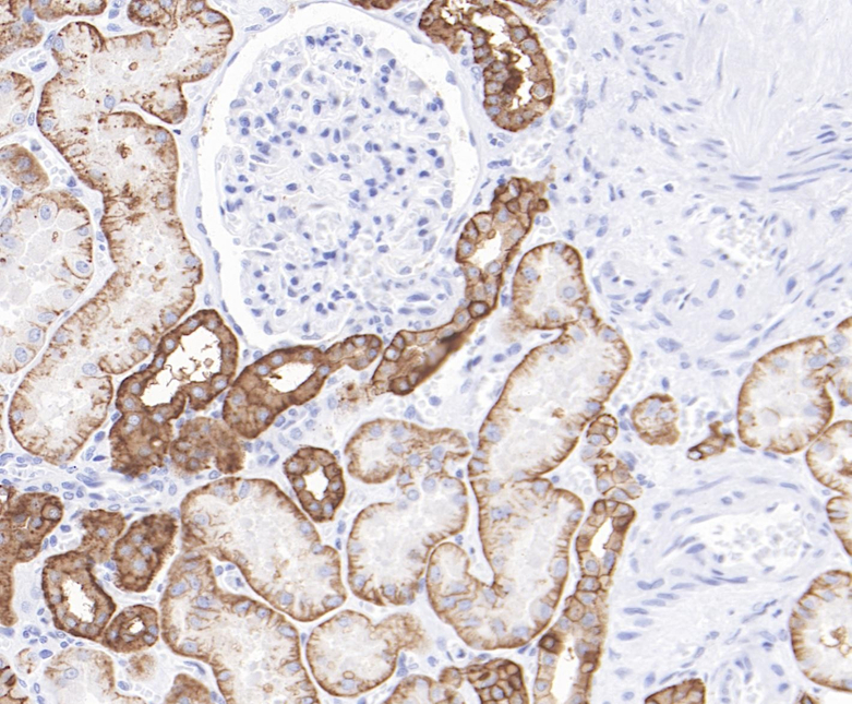 Carbonic Anhydrase 12 Rabbit Monoclonal Antibody(ARB584)