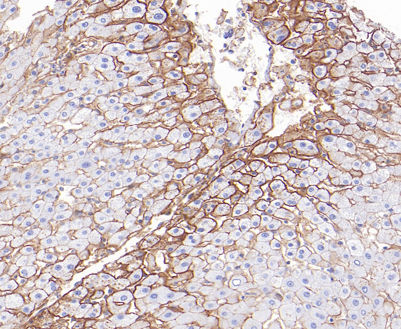 Carbonic Anhydrase 14 Rabbit Monoclonal Antibody(ARB580)