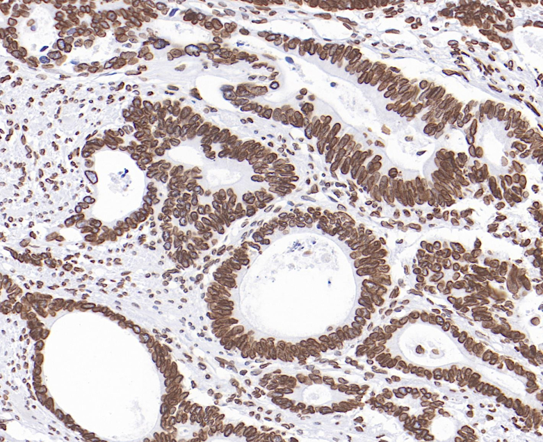 Lamin B1 Rabbit Monoclonal Antibody(ARB582)