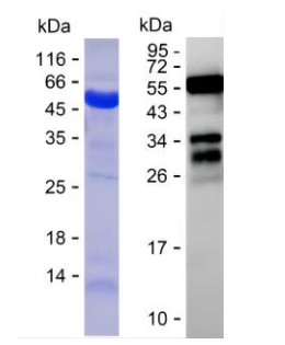 Recombinant Human Tau Protein
