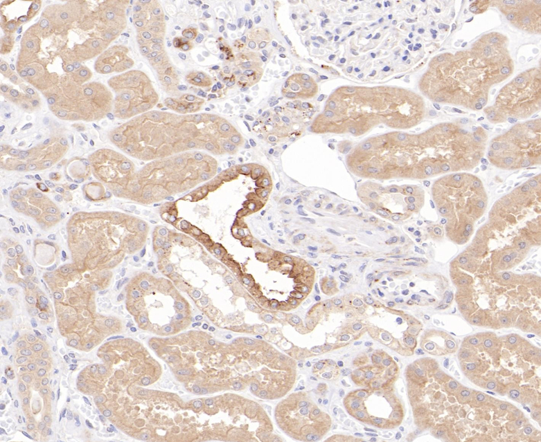 IL-11RA Rabbit Monoclonal Antibody(ARB581)