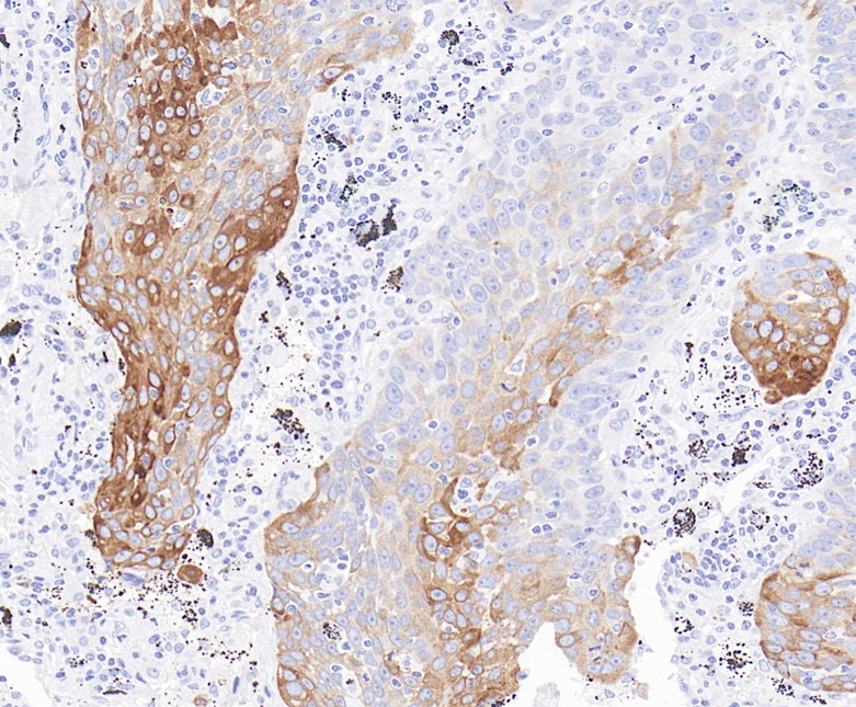 HER3 Rabbit Monoclonal Antibody(ARB585)