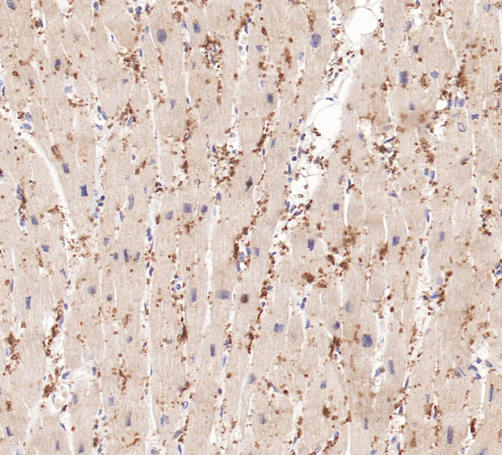 FABP3 Rabbit Monoclonal Antibody(ARB579)