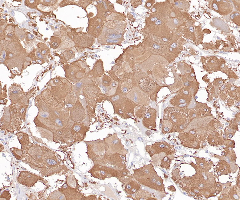 Tyrosine Hydroxylase Rabbit Monoclonal Antibody(ARB577)