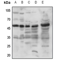 SREB3 Rabbit Polyclonal Antibody