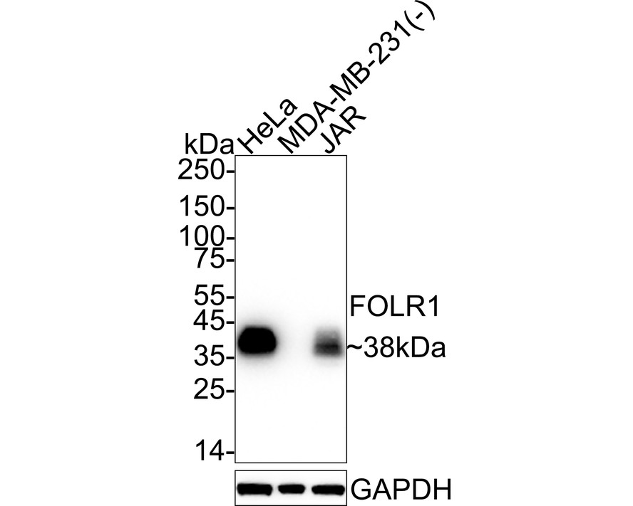 FOLR1 Rabbit Monoclonal Antibody(ARA992)
