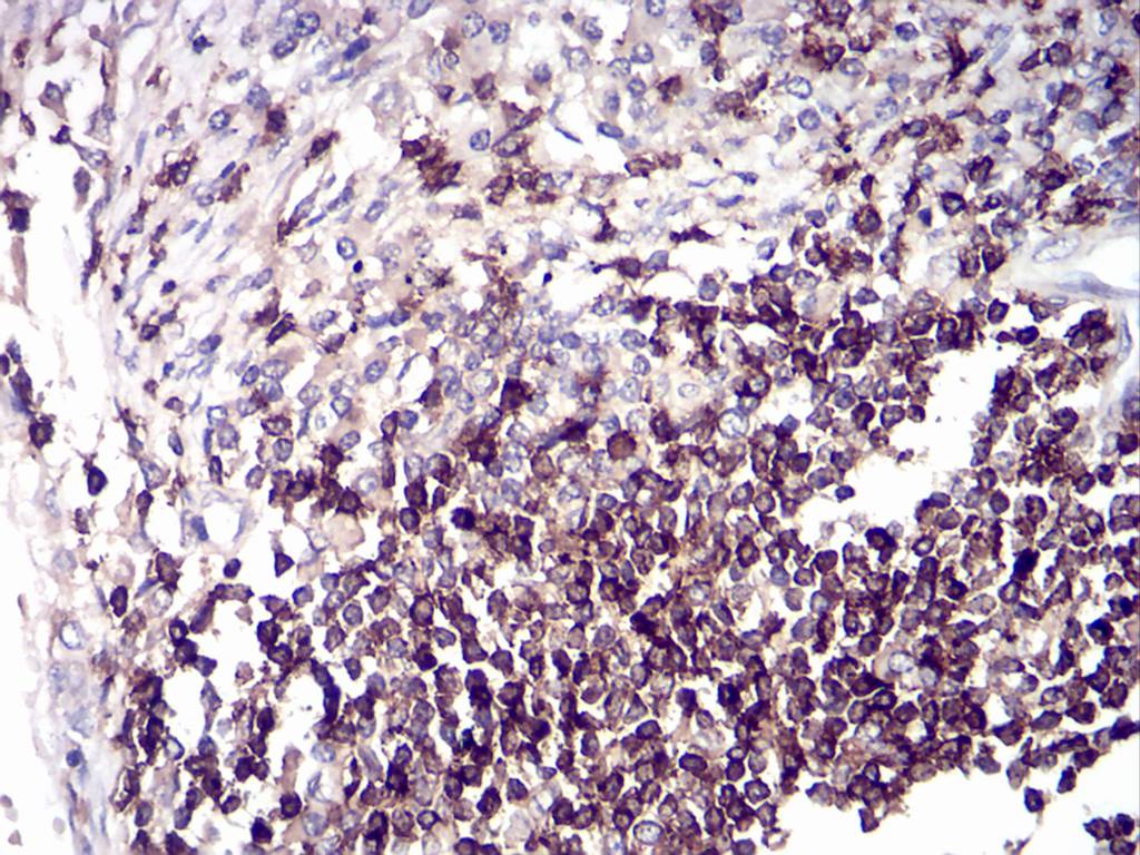 CD6 Mouse Monoclonal Antibody(ARA993)