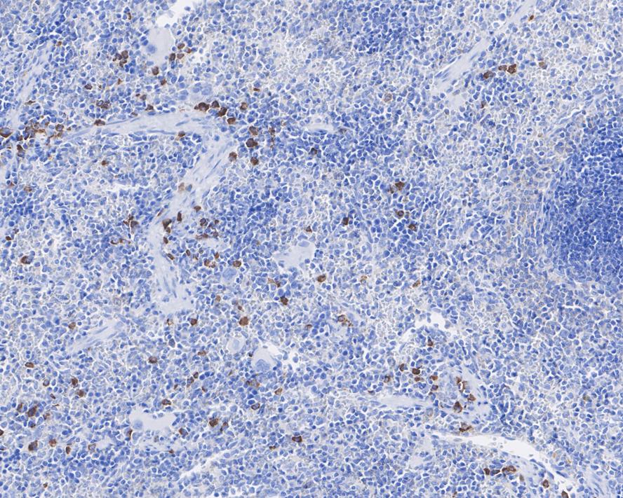 Thymidine Phosphorylase Mouse Monoclonal Antibody(ARA840)