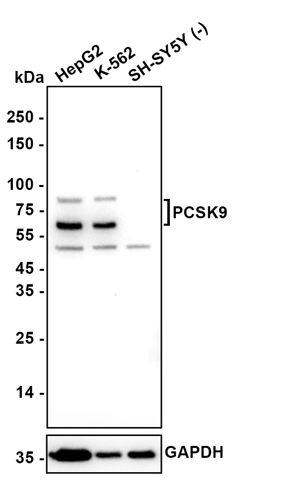 PCSK9 Mouse Monoclonal Antibody(ARA994)