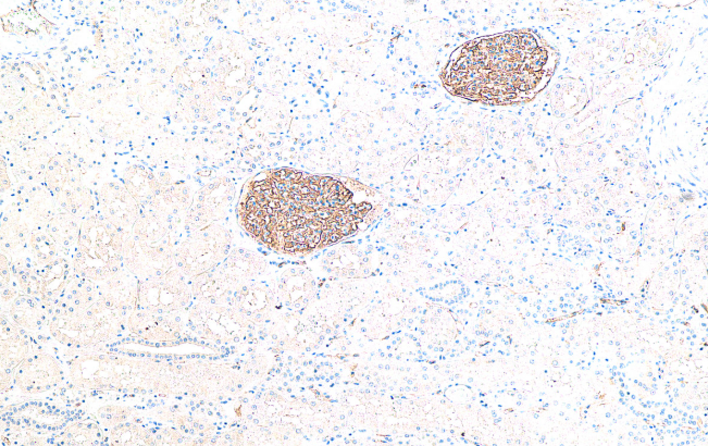 Podocalyxin Mouse Monoclonal Antibody(ARA996)
