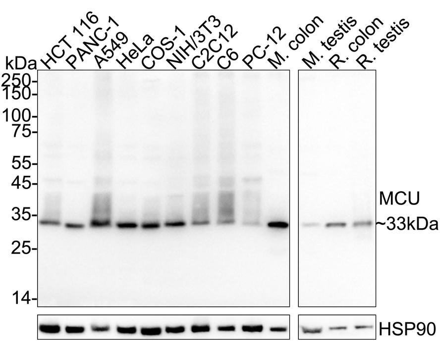 MCU Mouse Monoclonal Antibody(ARA997)