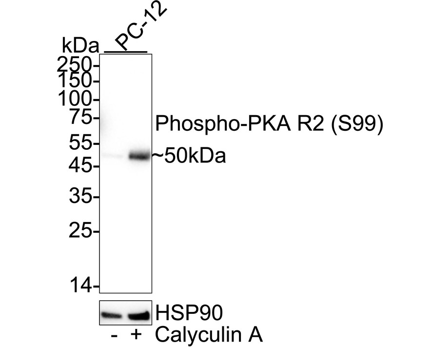Phospho-PKA R2 (S99) Rabbit Monoclonal Antibody(ARA722)