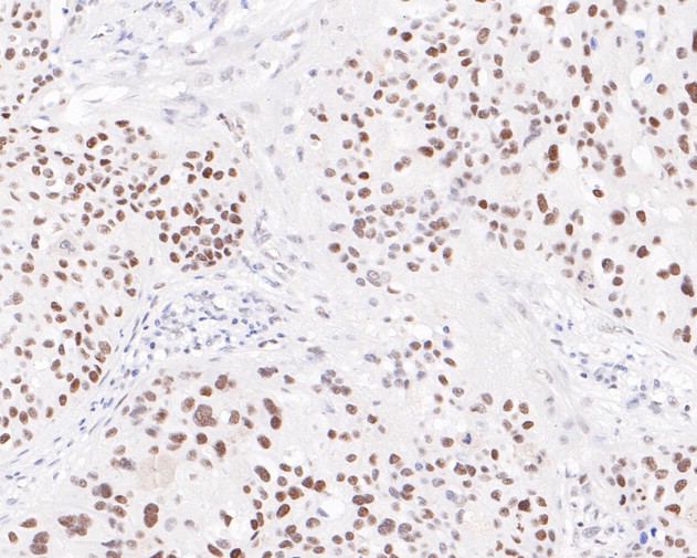 PMS2 Rabbit Monoclonal Antibody(ARA716)