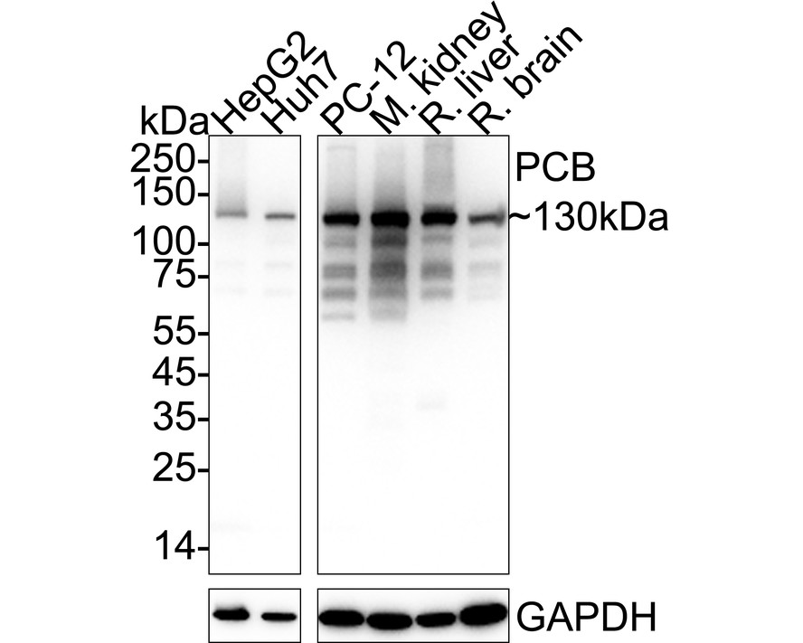 PCB Rabbit Monoclonal Antibody(ARA718)