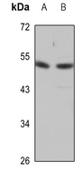 Desmin Rabbit Polyclonal Antibody