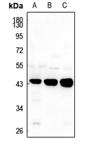 TGF beta 1 Rabbit Polyclonal Antibody