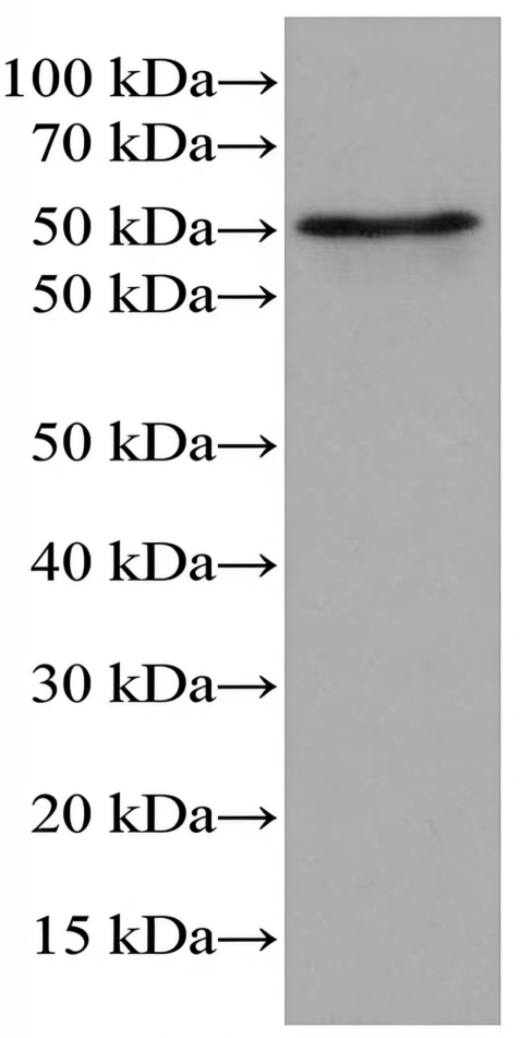 C9RANT Mouse Monoclonal Antibody(ARA714)