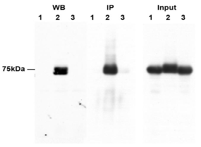 p-RIPK1(S166) Rabbit Monoclonal Antibody(YJY-1-5)
