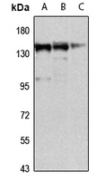 Mkl1/MRTFA Rabbit Polyclonal Antibody