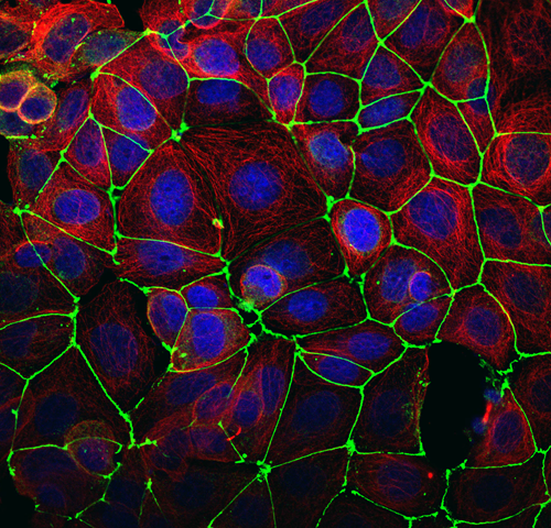 AREX&reg;&nbsp;Fluor 488 Rabbit IgG(H+L) Multiclonal Goat Monoclonal antibody