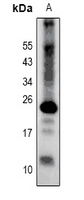 Claudin 2 Rabbit Polyclonal Antibody