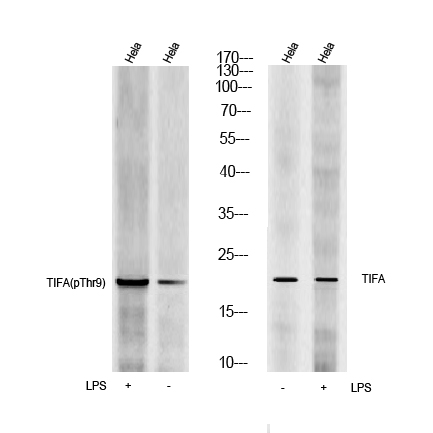 TIFA Rabbit Polyclonal Antibody