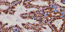 anti-NVL antibody