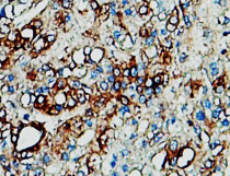 anti-Tissue Factor antibody