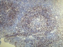 anti-CD5 antibody [A25-G]