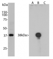 anti-Aurora B antibody [3F11]
