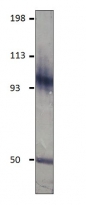 anti-PDE11A antibody