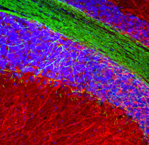 anti-MAP2ab antibody
