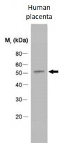 anti-CYP19A1 / Aromatase antibody [H4]