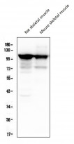 anti-alpha Actinin 3 antibody [9B5]