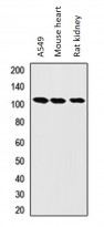 anti-LONP1 antibody