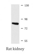 anti-MEP1A / Meprin alpha antibody