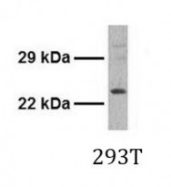 anti-ATF3 antibody