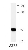 anti-INPP4B antibody