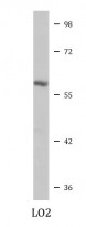 anti-FTCD / 58K Golgi protein antibody