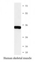 anti-SGCG / gamma Sarcoglycan antibody