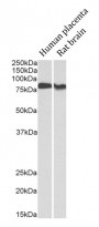 anti-PKC beta I antibody