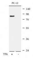 anti-B Raf phospho (Thr401) antibody