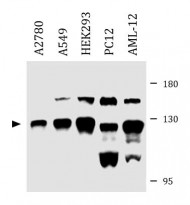 anti-N4BP1 antibody
