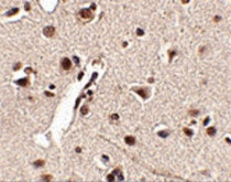 anti-MEX3A antibody
