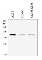 anti-PTCRA antibody