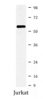 anti-ACVRL1 antibody