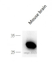 anti-14-3-3 zeta phospho (Ser58) antibody