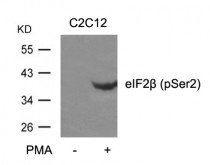 anti-eIF2 beta phospho (Ser2) antibody