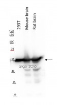 anti-beta Tubulin antibody
